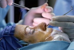 حكم عمليات التجميل