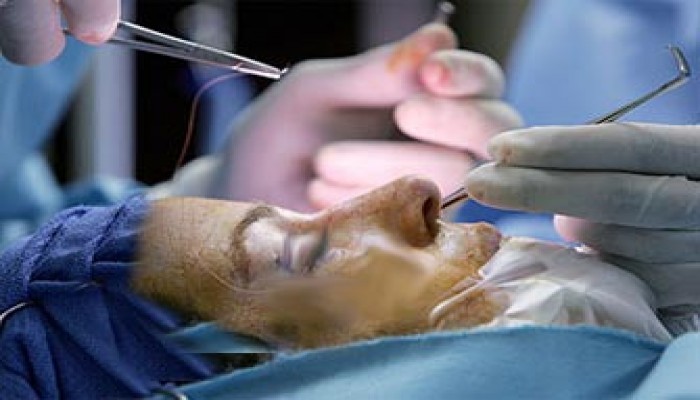 حكم عمليات التجميل