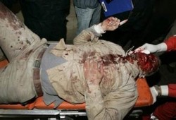 استشهاد 3 فلسطينيين وحالات حرجة ترشح بزيادة الأعداد