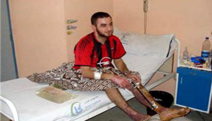 وفاة اثنين من الجرحى الفلسطينيين بمستشفى العريش