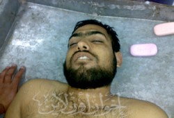 تعليمات أمنية بمنع فتح غرف العمليات للجرحى الفلسطينيين