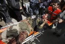 اليوم.. مؤتمر لاتحاد الأطباء العرب حول محرقة غزة