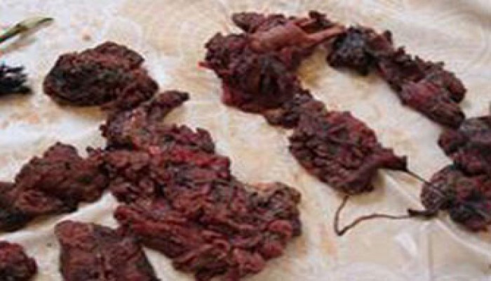 "كتائب القسام" تعرض أشلاء جنود صهاينة ومعدات غنمتها في (صيد الأفاعي 3)