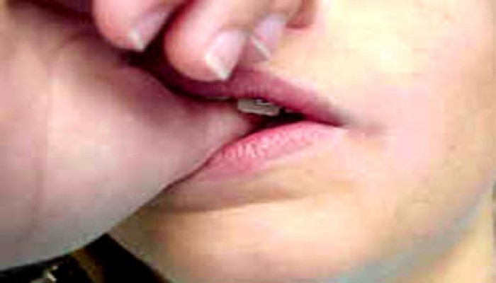 مشكلة مص الأصبع عند الأطفال