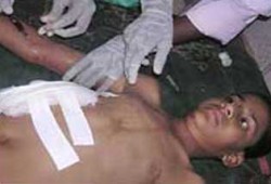 تفجيرات تستهدف مقابر للمسلمين بالهند وتوقع 162 بين قتيلٍ وجريحٍ