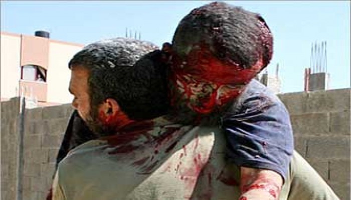 أسلحة صهيونية مُحَرَّمَة دوليًّا ضد الفلسطينيين واستشهاد أربعة أطفال