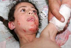 30% من أطفال غزة يعانون من أمراض نفسية نتيجة القصف الصهيوني