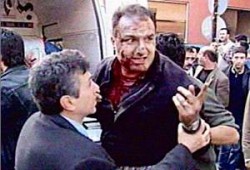 مقتل وإصابة العشرات في انفجارات إسطنبول