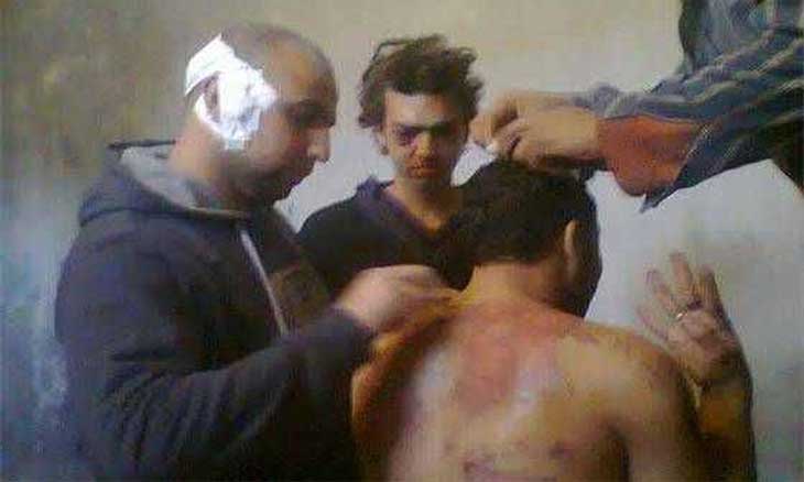 التعذيب في سجون العسكر إلى متى؟ ومن يتحمل المسئولية؟