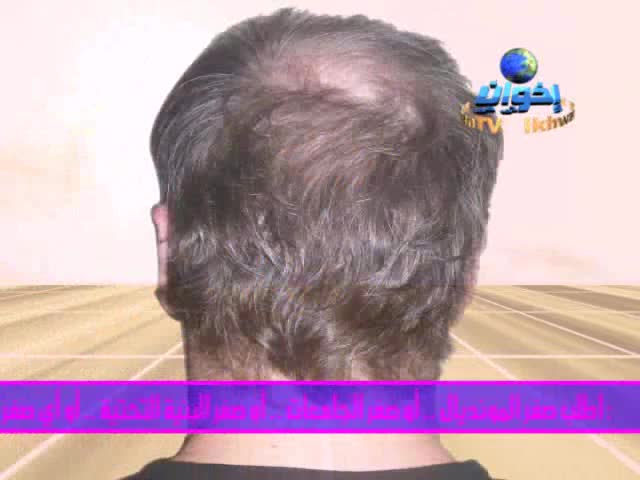 فأرة إعلانية (7)