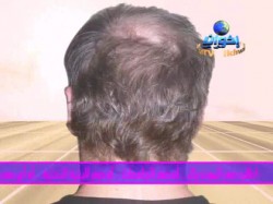 فأرة إعلانية (7)