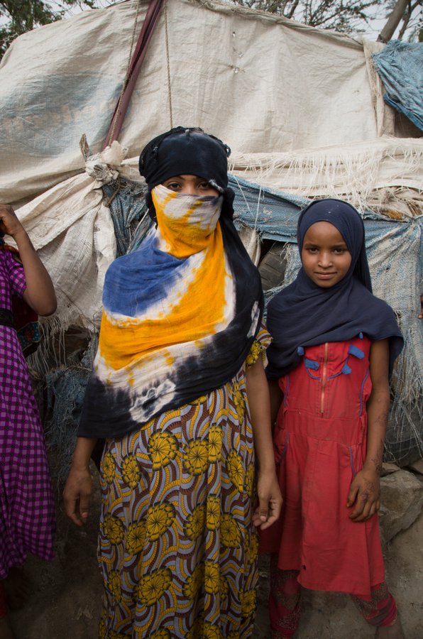 الأمم المتحدة: اليمن يعيش أسوأ أزمة إنسانية في العالم