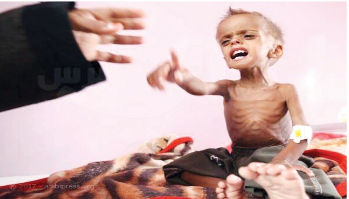 اليمن.. الأطفال في خطر والأمم المتحدة تطلب مليارات لتفادي مجاعة واسعة