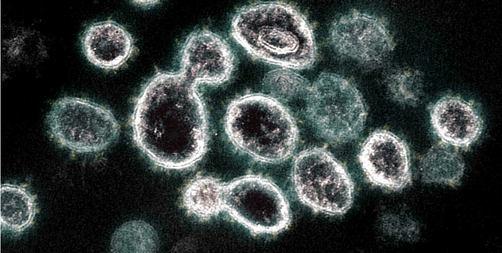 منظمة الصحة العالمية تحذر من سلالة جديدة لفيروس كورونا تدعى «مو»