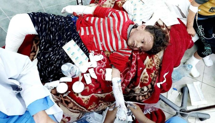 الأورومتوسطي: استهداف الاحتلال آلاف النازحين تكريس لجريمة الإبادة الجماعية