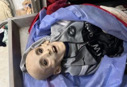 الطفل الكفارنة يرحل هيكلاً عظميًا شاهدًا على حرب التجويع والإبادة في غزة