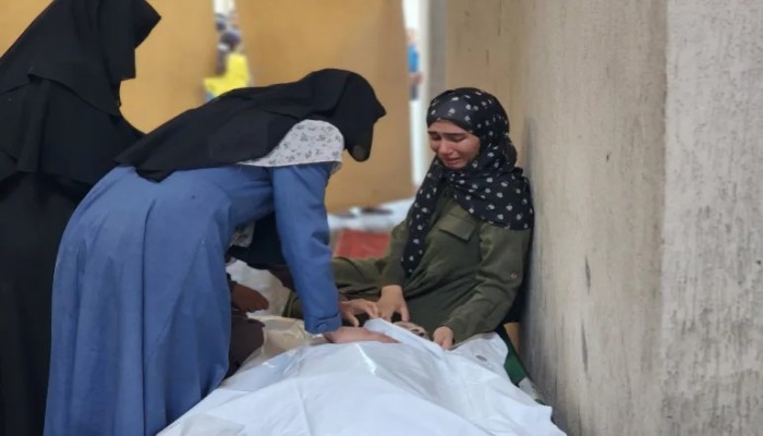 35303 شهداء وقرابة 80 ألف جريح بعدوان الاحتلال على غزة