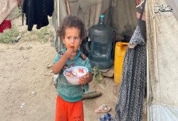 الأونروا تسجل 40 ألف إصابة بالكبد الوبائي في غزة