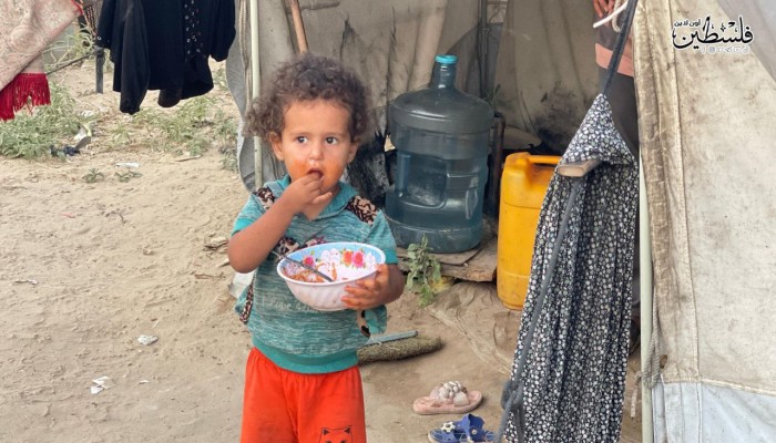 الأونروا تسجل 40 ألف إصابة بالكبد الوبائي في غزة