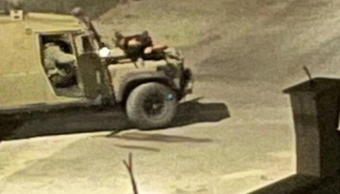 استشهاد شابين متأثرين بإصابتهما برصاص الاحتلال في جنين وطولكرم