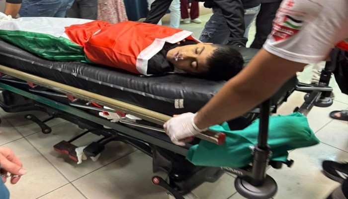 شهيد و13 إصابة خلال العدوان المتواصل شمال القدس المحتلة