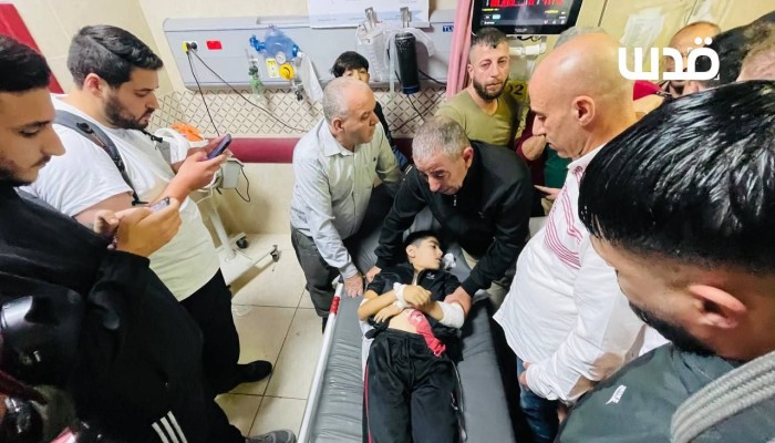 استشهاد الطفل عبد الله هواش برصاص الاحتلال في نابلس