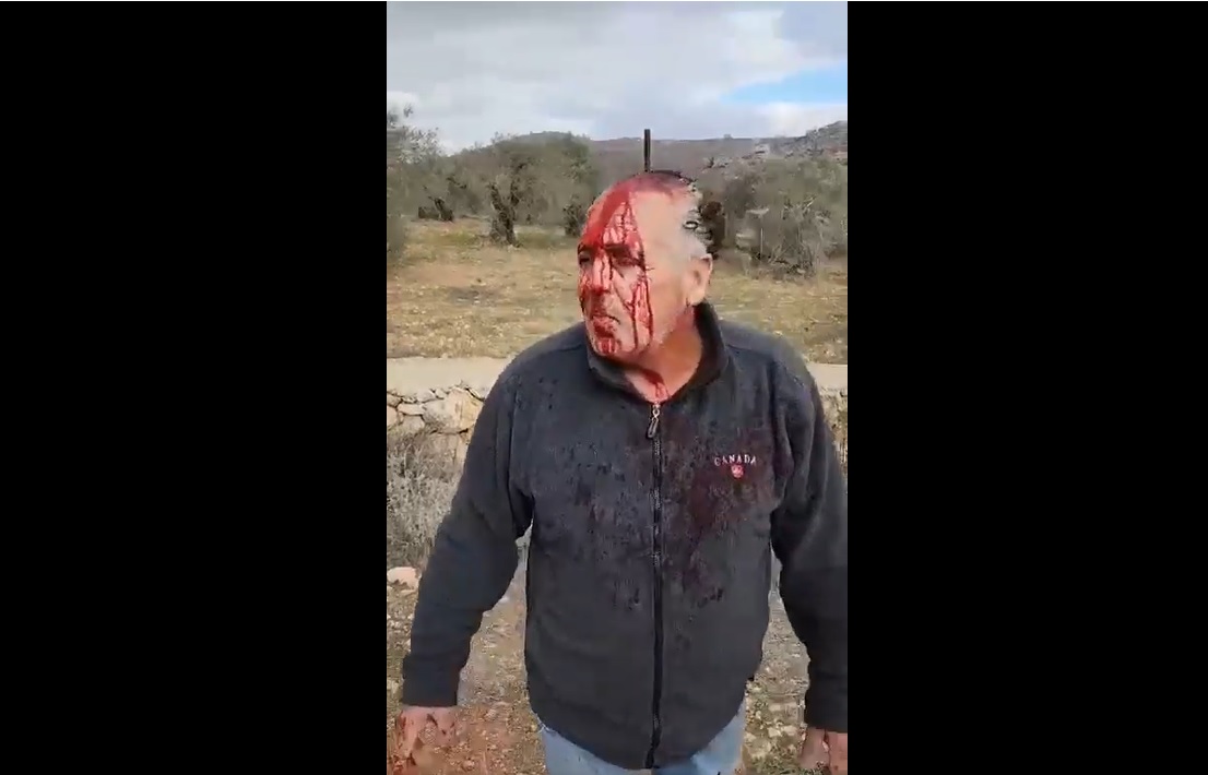 إصابات واعتقالات في هجوم للمستوطنين وجيش الاحتلال على سلواد