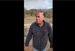 إصابات واعتقالات في هجوم للمستوطنين وجيش الاحتلال على سلواد