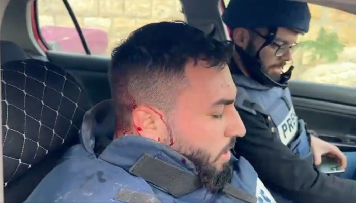 إصابات برصاص الاحتلال واختناق بقنابل الغاز في الخليل والقدس