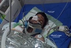 شهيدان بعدوان الاحتلال على رفح وخانيونس