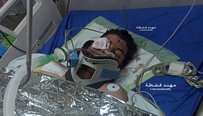 شهيدان بعدوان الاحتلال على رفح وخانيونس