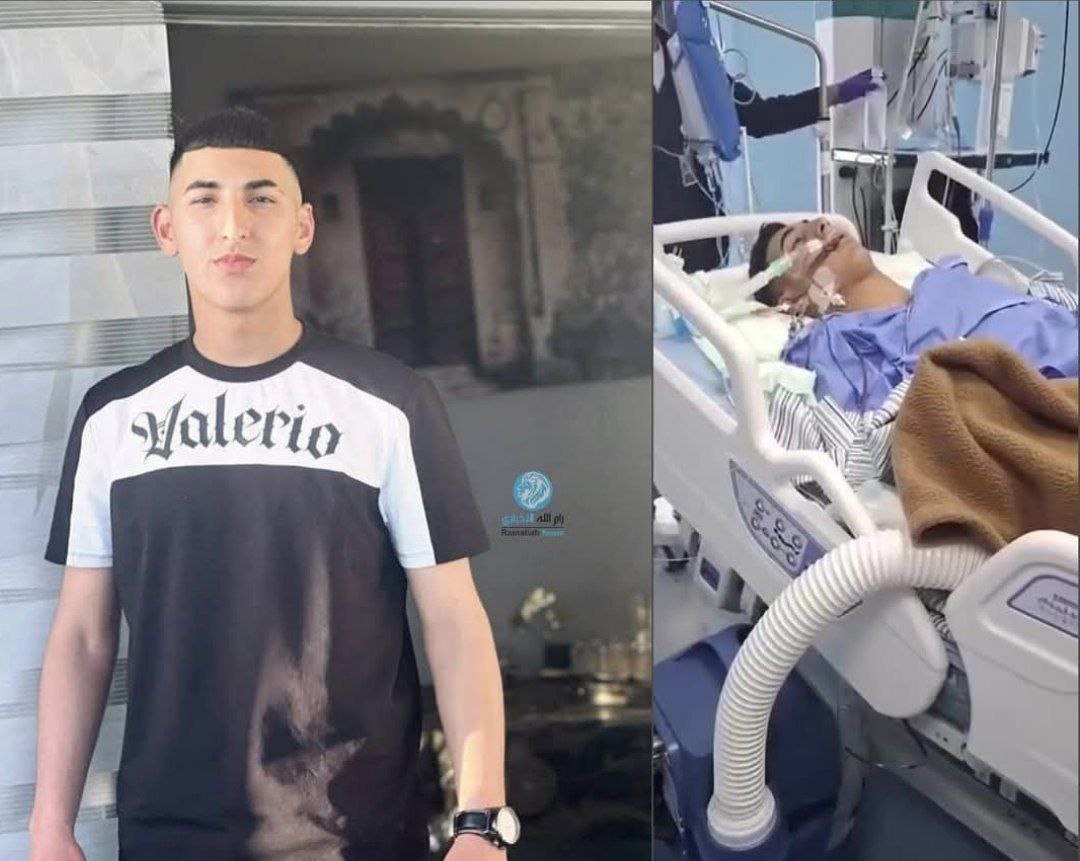 استشهاد شاب في مخيم الجلزون متأثرًا بإصابته