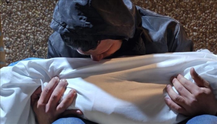 18 شهيدا و77 جريحا في غزة خلال 24 ساعة