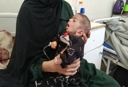 استشهاد رضيعة في غزة بسبب سوء التغذية