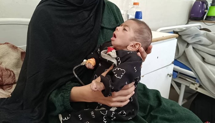 استشهاد رضيعة في غزة بسبب سوء التغذية