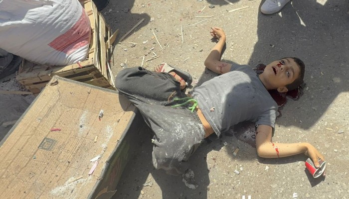 32 شهيداً وعشرات الجرحى في مجزرة للاحتلال بغزة