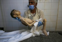 26 شهيدا في غزة خلال 24 ساعة بسبب انعدام الغذاء والدواء