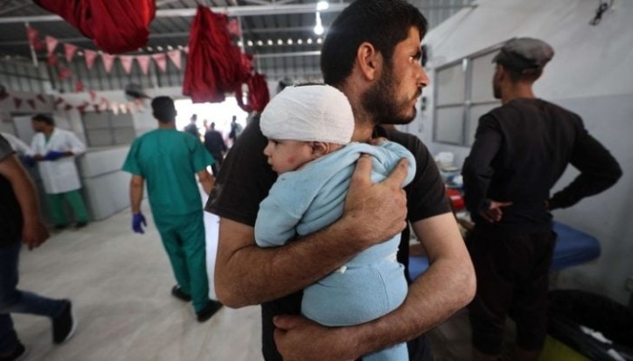 سوء التغذية الحاد في غزة يهدد 14 ألف رضيع بالموت جوعاً