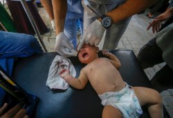 أطفال غزة يستيقظون خلال العمليات بسبب نقص التخدير