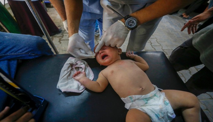 أطفال غزة يستيقظون خلال العمليات بسبب نقص التخدير