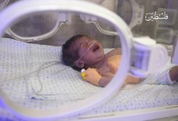 تحذير من تصاعد أعداد الأطفال المصابين بالحمى الشوكي في غزة