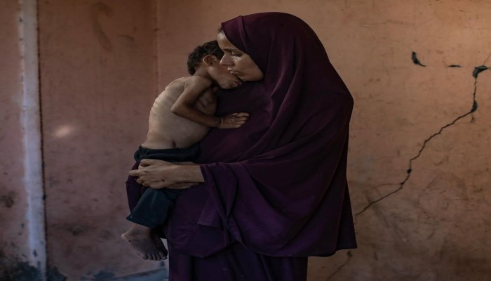 الأونروا: الاحتلال يتعمد تجويع غزة ومليون طفل في خطر