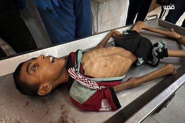 استشهاد 10 مواطنين جوعا في غزة خلال 24 ساعة