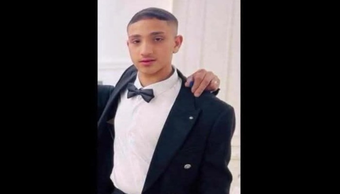 استشهاد فتى فلسطيني متأثرًا بإصابته برصاص الاحتلال في نابلس