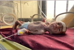 استشهاد  5 فلسطينيين جوعًا في غزة خلال 24 ساعة