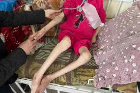 غزة.. موت بطيء تحت أنياب التجويع