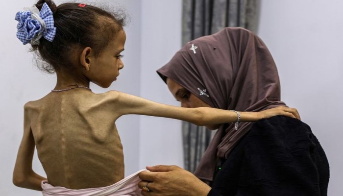 مؤشرات الغذاء في قطاع غزة تتجاوز عتبات المجاعة