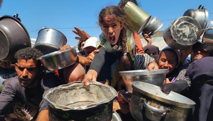 17 ألف طفل دخلوا مرحلة سوء التغذية التام في غزة