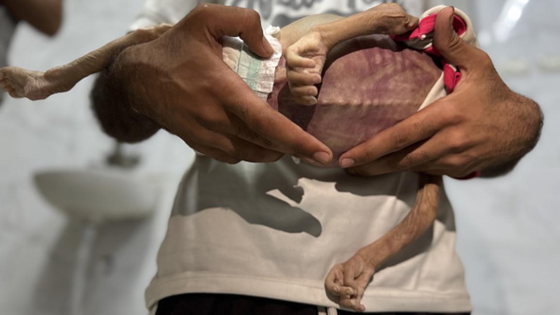 استشهاد 7 فلسطينيين جوعا في غزة والعدد يرتفع إلى 154