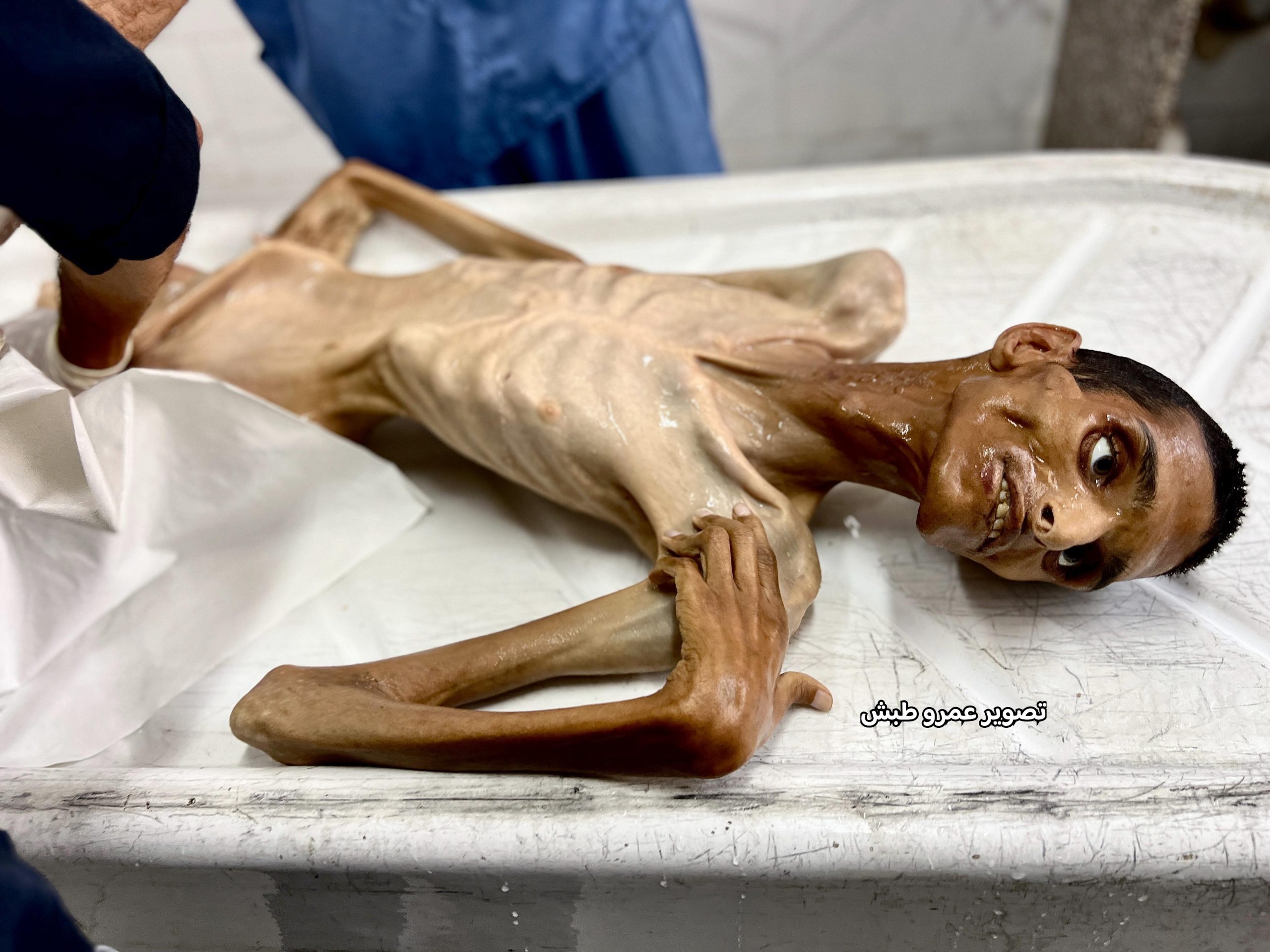 اليوم الـ 135 لتجدد العدوان على غزة.. حرب الإبادة مستمرة